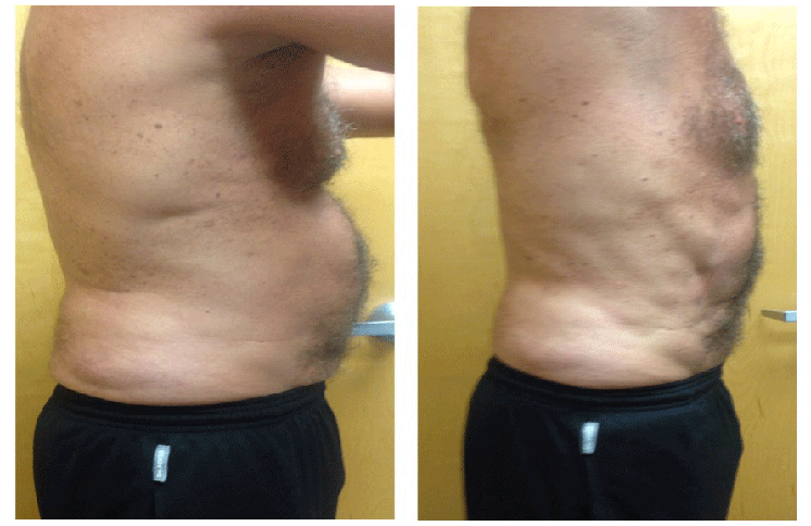male abdomen